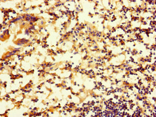RTN4IP1 / NIMP Antibody - Immunohistochemistry of paraffin-embedded human appendix tissue using RTN4IP1 Antibody at dilution of 1:100