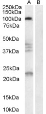 RTN4R Antibody - Antibody (0.3 ug/ml) staining of Human Brain lysate (35 ug protein in RIPA buffer) with (B) and without (A) blocking with the immunizing peptide. Primary incubation was 1 hour. Detected by chemiluminescence.