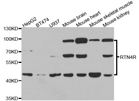 RTN4R Antibody - Western blot analysis of extracts of various cell lines.