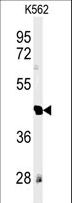 RTN4RL1 / NGRH2 Antibody - Western blot of RTN4RL1 Antibody in K562 cell line lysates (35 ug/lane). RTN4RL1 (arrow) was detected using the purified antibody.