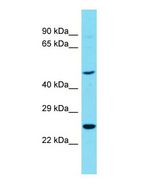 RTN4RL1 / NGRH2 Antibody - Western blot of RTN4RL1 Antibody - C-terminal region with human OVCAR-3 cells lysate.  This image was taken for the unconjugated form of this product. Other forms have not been tested.
