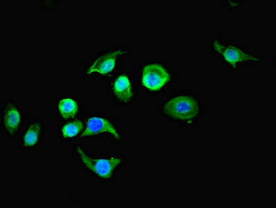 RTN4RL1 / NGRH2 Antibody - Immunofluorescent analysis of A549 cells using RTN4RL1 Antibody at dilution of 1:100 and Alexa Fluor 488-congugated AffiniPure Goat Anti-Rabbit IgG(H+L)