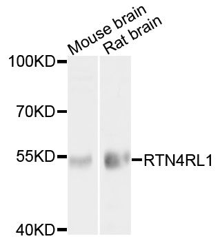 RTN4RL1 / NGRH2 Antibody - Western blot analysis of extracts of various cell lines, using RTN4RL1 antibody at 1:1000 dilution. The secondary antibody used was an HRP Goat Anti-Rabbit IgG (H+L) at 1:10000 dilution. Lysates were loaded 25ug per lane and 3% nonfat dry milk in TBST was used for blocking. An ECL Kit was used for detection and the exposure time was 20s.