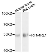 RTN4RL1 / NGRH2 Antibody - Western blot analysis of extracts of various cell lines, using RTN4RL1 antibody at 1:1000 dilution. The secondary antibody used was an HRP Goat Anti-Rabbit IgG (H+L) at 1:10000 dilution. Lysates were loaded 25ug per lane and 3% nonfat dry milk in TBST was used for blocking. An ECL Kit was used for detection and the exposure time was 20s.
