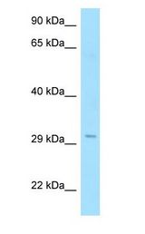 RTP1 Antibody - RTP1 antibody Western Blot of Fetal Heart.  This image was taken for the unconjugated form of this product. Other forms have not been tested.