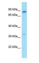 RTP1 Antibody - RTP1 antibody Western Blot of MCF7.  This image was taken for the unconjugated form of this product. Other forms have not been tested.