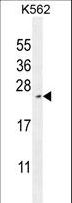 RTP4 / IFRG28 Antibody - RTP4 Antibody western blot of K562 cell line lysates (35 ug/lane). The RTP4 antibody detected the RTP4 protein (arrow).