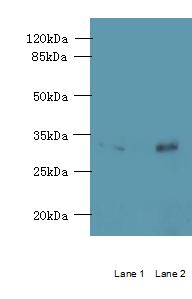 RTP4 / IFRG28 Antibody - Western blot. All lanes: RTP4 antibody at 5 ug/ml. Lane 1: K562 whole cell lysate. Lane 2: Mouse thymus tissue. Secondary antibody: Goat polyclonal to Rabbit IgG at 1:10000 dilution. Predicted band size: 28 kDa. Observed band size: 28 kDa.