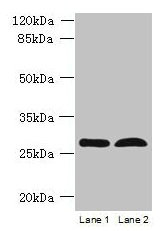 RTP4 / IFRG28 Antibody - Western blot All lanes: RTP4 antibody at 5µg/ml Lane 1: K562 whole cell lysate Lane 2: Mouse thymus tissue Secondary Goat polyclonal to rabbit IgG at 1/10000 dilution Predicted band size: 28 kDa Observed band size: 28 kDa