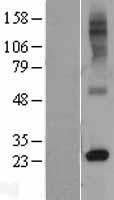 RTP4 / IFRG28 Protein - Western validation with an anti-DDK antibody * L: Control HEK293 lysate R: Over-expression lysate