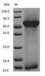 RuBisCO Protein - (Tris-Glycine gel) Discontinuous SDS-PAGE (reduced) with 5% enrichment gel and 15% separation gel.
