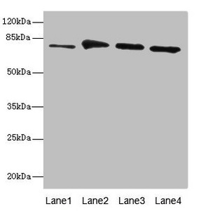 RUFY1 Antibody - Western blot All Lanes: RUFY1 antibody at 7.54ug/ml Lane 1: Mouse kidney tissue Lane 2: Mouse heart tissue Lane 3: Mouse lung tissue Lane 4: Mouse gonadal tissue Secondary Goat polyclonal to Rabbit IgG at 1/10000 dilution Predicted band size: 80,70,45 kDa Observed band size: 80 kDa