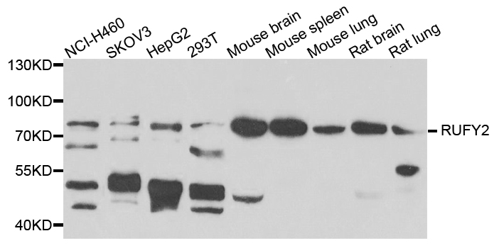 RUFY2 Antibody - Western blot analysis of extracts of various cells.