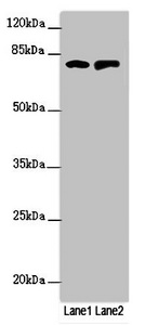 RUFY2 Antibody - Western blot All Lanes:RUFY2 antibody at 1.69ug/ml Lane 1 : PC-3 whole cell lysate Lane 2 : Mouse spleen tissue Secondary Goat polyclonal to Rabbit IgG at 1/10000 dilution Predicted band size: 76,71,75,47,44 kDa Observed band size: 75 kDa