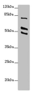 RUFY2 Antibody - Western blot All Lanes:RUFY2 antibody at 2.4ug/ml +PC-3 whole cell lysate Goat polyclonal to rabbit at 1/10000 dilution Predicted band size: 76,71,75,47,44 kDa Observed band size: 75,55,49 kDa