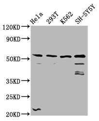 RUFY3 / RIPX Antibody - Western Blot Positive WB detected in: Hela whole cell lysate, 293T whole cell lysate, K562 whole cell lysate, SH-SY5Y whole cell lysate All Lanes: RUFY3 antibody at 3.71µg/ml Secondary Goat polyclonal to rabbit IgG at 1/50000 dilution Predicted band size: 53, 56, 71, 65 KDa Observed band size: 53 KDa