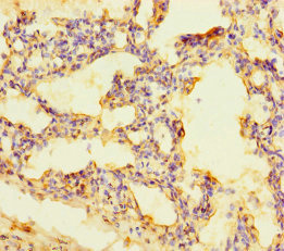 RUFY4 Antibody - Immunohistochemistry of paraffin-embedded human lung tissue using RUFY4 Antibody at dilution of 1:100