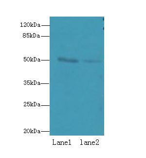 RUNDC3A Antibody - Western blot. All lanes: RUNDC3A antibody at 12 ug/ml. Lane 1: HeLa whole cell lysate. Lane 2: A549 whole cell lysate. Secondary Goat polyclonal to Rabbit IgG at 1:10000 dilution. Predicted band size: 50 kDa. Observed band size: 50 kDa.