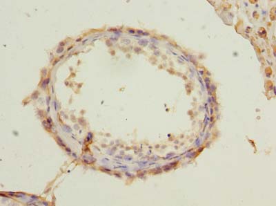 RUNDC3A Antibody - Immunohistochemistry of paraffin-embedded human testis tissue using antibody at dilution of 1:100.