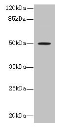 RUNDC3A Antibody - Western blot All lanes: RUNDC3A antibody at 12µg/ml Lane 1: Hela whole cell lysate Lane 2: A549 whole cell lysate Secondary Goat polyclonal to rabbit IgG at 1/10000 dilution Predicted band size: 50, 46, 42 kDa Observed band size: 50 kDa