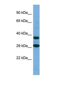 RUNDC3B Antibody - Western blot of Human 293T. RUNDC3B antibody dilution 1.0 ug/ml.  This image was taken for the unconjugated form of this product. Other forms have not been tested.