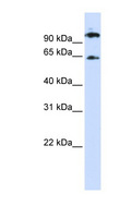 RUNX1T1 / ETO Antibody - RUNX1T1 antibody Western blot of 293T cell lysate. This image was taken for the unconjugated form of this product. Other forms have not been tested.