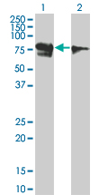 RUNX1T1 / ETO Antibody - Western Blot analysis of RUNX1T1 expression in transfected 293T cell line by RUNX1T1 monoclonal antibody (M01), clone 5A12.Lane 1: RUNX1T1 transfected lysate(67.566 KDa).Lane 2: Non-transfected lysate.