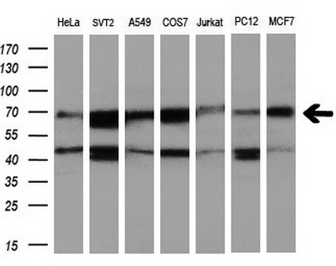 RUNX1T1 / ETO Antibody - Western blot of extracts (10ug) from 7 different cell lines by using anti-RUNX1T1 monoclonal antibody at 1:200 dilution.