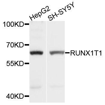 RUNX1T1 / ETO Antibody - Western blot analysis of extracts of various cell lines, using RUNX1T1 antibody at 1:1000 dilution. The secondary antibody used was an HRP Goat Anti-Rabbit IgG (H+L) at 1:10000 dilution. Lysates were loaded 25ug per lane and 3% nonfat dry milk in TBST was used for blocking. An ECL Kit was used for detection and the exposure time was 1s.