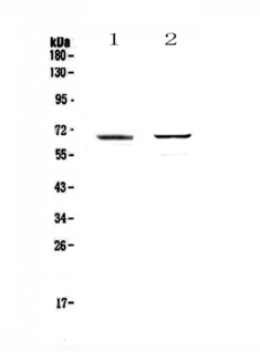 RUNX1T1 / ETO Antibody - Western blot - Anti-RUNX1T1/ETO antibody