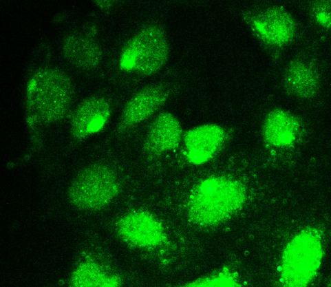RUNX1T1 / ETO Antibody - IF analysis of RUNX1T1 using anti-RUNX1T1 antibody RUNX1T1 was detected in immunocytochemical section of U20S cell. Enzyme antigen retrieval was performed using IHC enzyme antigen retrieval reagent for 15 mins. The tissue section was blocked with 10% goat serum. The tissue section was then incubated with 2µg/mL rabbit anti-RUNX1T1 Antibody overnight at 4°C. DyLight®488 Conjugated Goat Anti-Rabbit IgG was used as secondary antibody at 1:100 dilution and incubated for 30 minutes at 37°C. Visualize using a fluorescence microscope and filter sets appropriate for the label used.