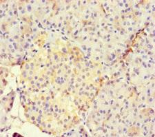 RUNX1T1 / ETO Antibody - Immunohistochemistry of paraffin-embedded human pancreatic tissue at dilution of 1:100