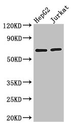 RUNX1T1 / ETO Antibody - Western Blot Positive WB detected in:HepG2 whole cell lysate,Jurkat whole cell lysate All Lanes: RUNX1T1 antibody at 2.8ug/ml Secondary Goat polyclonal to rabbit IgG at 1/50000 dilution Predicted band size: 68,65,69,64,49,45 kDa Observed band size: 68 kDa
