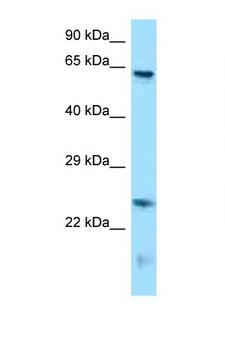 RUNX1T1 / ETO Antibody - RUNX1T1 antibody Western blot of Mouse Brain lysate. Antibody concentration 1 ug/ml.  This image was taken for the unconjugated form of this product. Other forms have not been tested.