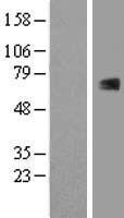 RUNX1T1 / ETO Protein - Western validation with an anti-DDK antibody * L: Control HEK293 lysate R: Over-expression lysate