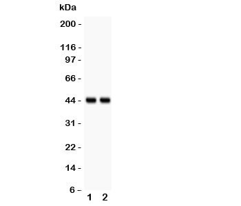 RUNX3 Antibody - Western blot testing of RUNX3 antibody and 1. A431, 2. U20S; Predicted/observed size ~44KD