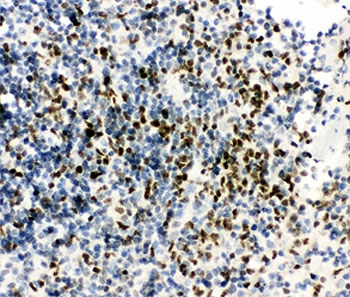 RUNX3 Antibody - IHC-P testing of mouse spleen