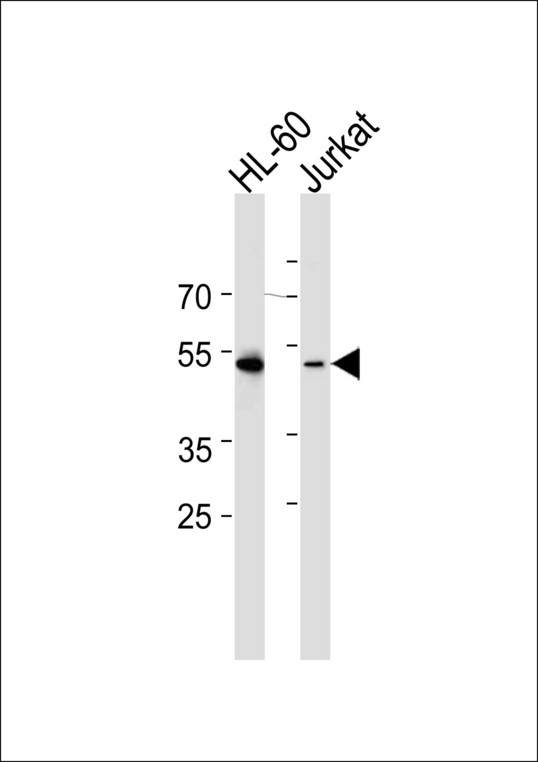 RUNX3 Antibody - Western blot of lysates from HL-60, Jurkat cell line (from left to right), using RUNX3 Antibody. Antibody was diluted at 1:1000 at each lane. A goat anti-rabbit IgG H&L (HRP) at 1:5000 dilution was used as the secondary antibody. Lysates at 35ug per lane.
