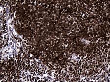 RUNX3 Antibody - Immunohistochemical staining of paraffin-embedded Human lymph node tissue within the normal limits using anti-RUNX3 mouse monoclonal antibody. (Heat-induced epitope retrieval by 1mM EDTA in 10mM Tris buffer. (pH8.5) at 120°C for 3 min. (1:500)