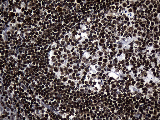RUNX3 Antibody - Immunohistochemical staining of paraffin-embedded Human tonsil within the normal limits using anti-RUNX3 mouse monoclonal antibody. (Heat-induced epitope retrieval by 1mM EDTA in 10mM Tris buffer. (pH8.5) at 120°C for 3 min. (1:500)