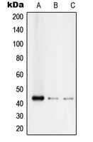 RUNX3 Antibody - Western blot analysis of RUNX3 expression in Jurkat (A); Raji (B); SW480 (C) whole cell lysates.