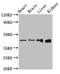 RUNX3 Antibody - Western Blot Positive WB detected in:Rat heart tissue,Mouse brain tissue,Mouse liver tissue,Mouse kidney tissue All Lanes:RUNX3 antibody at 3µg/ml Secondary Goat polyclonal to rabbit IgG at 1/50000 dilution Predicted band size: 45,46 KDa Observed band size: 45 KDa
