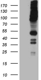 RUSC2 Antibody - HEK293T cells were transfected with the pCMV6-ENTRY control. (Left lane) or pCMV6-ENTRY RUSC2. (Right lane) cDNA for 48 hrs and lysed. Equivalent amounts of cell lysates. (5 ug per lane) were separated by SDS-PAGE and immunoblotted with anti-RUSC2. (1:2000)