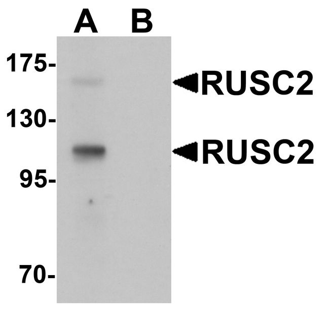 RUSC2 Antibody - Western blot analysis of RUSC2 in SK-N-SH cell lysate with RUSC2 antibody at 1 ug/ml in (A) the absence and (B) the presence of blocking peptide
