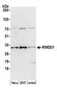 RWDD1 Antibody - Detection of human RWDD1 by western blot. Samples: Whole cell lysate (15 µg) from HeLa, HEK293T, and Jurkat cells prepared using NETN lysis buffer. Antibody: Affinity purified rabbit anti-RWDD1 antibody used for WB at 1:1000. Detection: Chemiluminescence with an exposure time of 3 minutes.