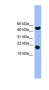 RWDD1 Antibody - RWDD1 antibody Western blot of Jurkat lysate.  This image was taken for the unconjugated form of this product. Other forms have not been tested.