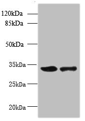 RWDD2A Antibody - Western blot All lanes: RWDD2A antibody at 0.2µg/ml Lane 1: Mouse thymus tissue Lane 2: A549 whole cell lysate Secondary Goat polyclonal to rabbit IgG at 1/10000 dilution Predicted band size: 34, 28 kDa Observed band size: 34 kDa