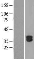 RWDD2B / C21orf6 Protein - Western validation with an anti-DDK antibody * L: Control HEK293 lysate R: Over-expression lysate