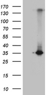 RWDD3 Antibody - HEK293T cells were transfected with the pCMV6-ENTRY control. (Left lane) or pCMV6-ENTRY RWDD3. (Right lane) cDNA for 48 hrs and lysed. Equivalent amounts of cell lysates. (5 ug per lane) were separated by SDS-PAGE and immunoblotted with anti-RWDD3. (1:2000)