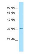 RWDD3 Antibody - RWDD3 antibody Western Blot of 293T.  This image was taken for the unconjugated form of this product. Other forms have not been tested.